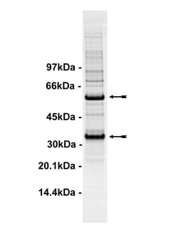Eurofins DiscoverX Cdk5/p35 Protein, Active 10 &mu;g | Buy Online | Eurofins DiscoverX | Fisher Scientific
